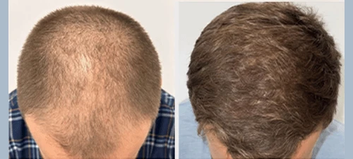 Patient Result Image